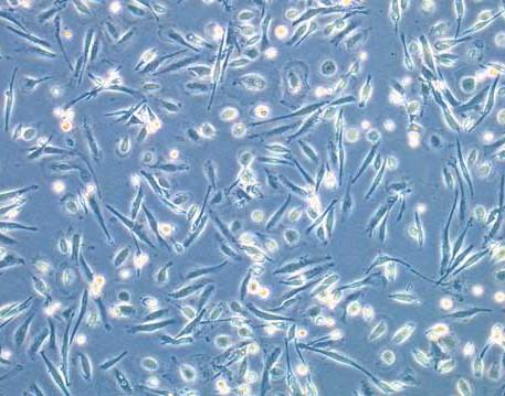 Fotografía Microscópica del Nuevo Coronavirus o SARS COV 2